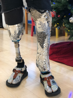 custom bilateral below the knee prosthetics
